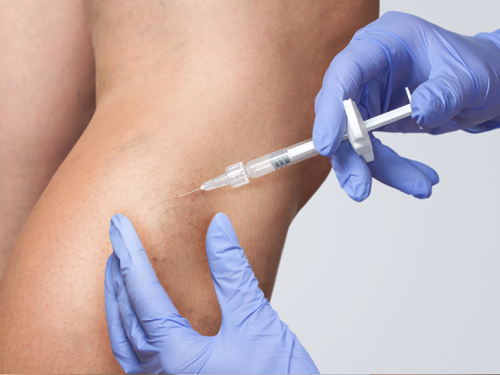 veins on leg being injected with needle