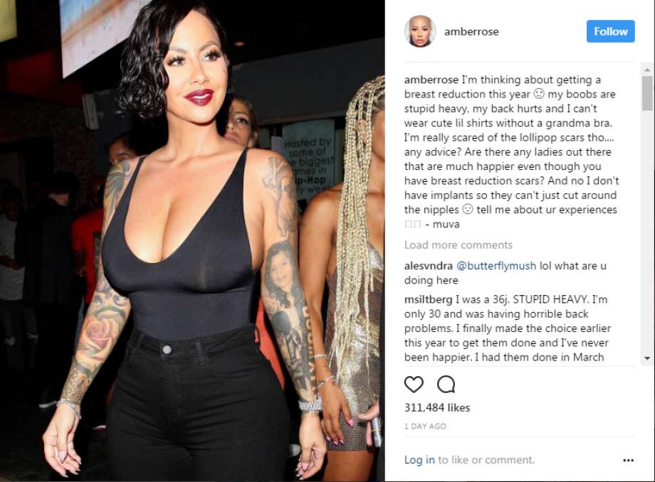 https://www.theprivateclinic.co.uk/wp-content/uploads/amber-rose-breast-reduction-the-private-clinic.jpg